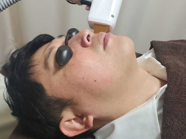 青髭解消！ヒゲの悩みはありませんか？の画像