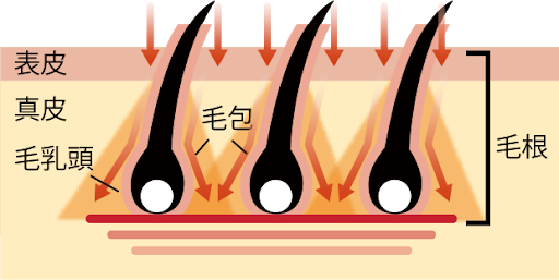 ≪メンズ脱毛≫脱毛のメカニズムと効果の画像