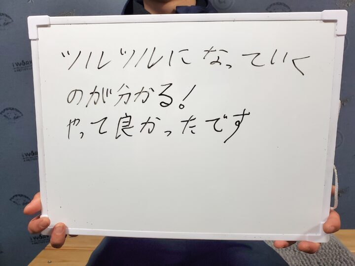 ヒゲ脱毛を続けるべき？実際に試したお客様の声の画像