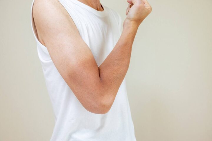 脱毛には日焼けがNG！肌トラブルを防ぐための紫外線対策の画像